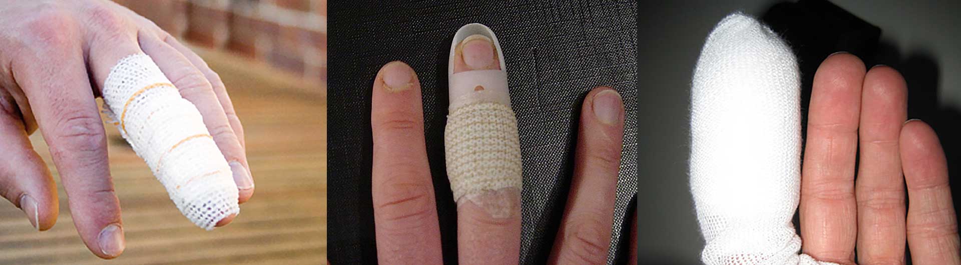 injured fingers